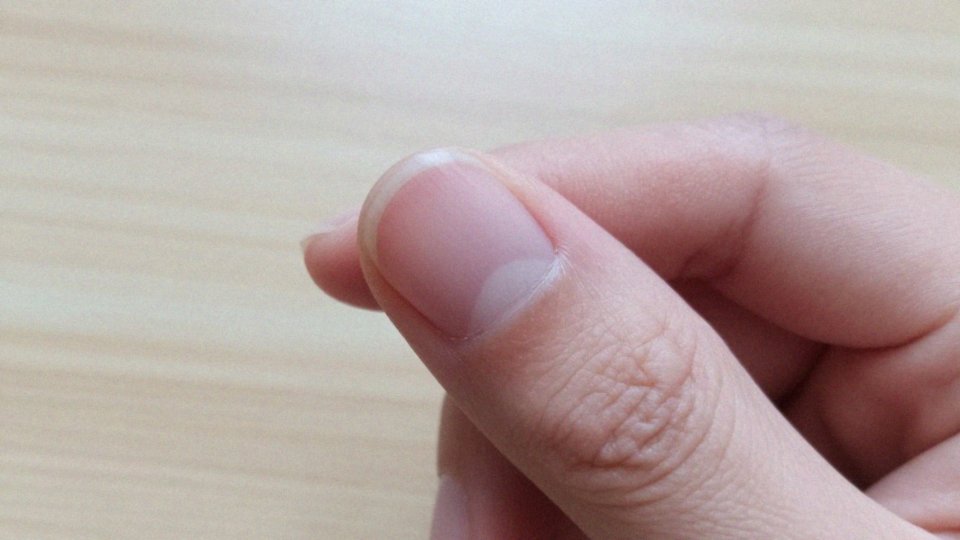 Jakie są objawy i skutki niedoboru cynku?